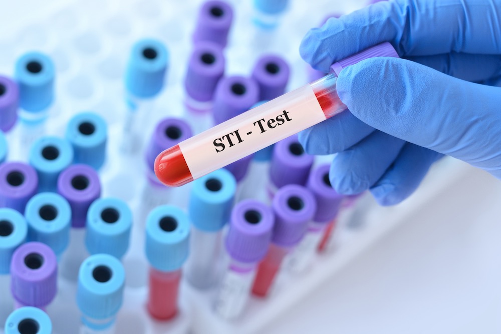 Läkare som håller ett blodprovsrör med STI test och analys